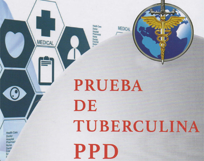 Prueba de tuberculina PPD